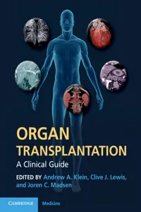 Organ Transplantation_cover