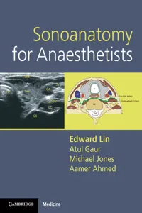 Sonoanatomy for Anaesthetists_cover