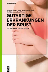 Gutartige Erkrankungen der Brust_cover