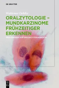 Oralzytologie - Mundkarzinome frühzeitiger erkennen_cover