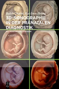 3D-Sonographie in der pränatalen Diagnostik_cover