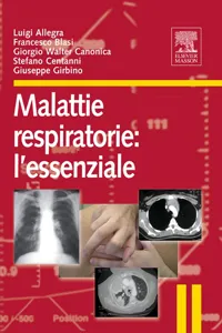 Malattie repiratorie. L'essenziale_cover