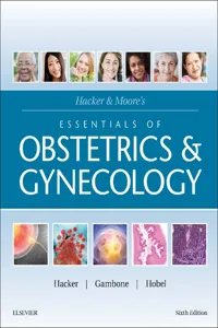 Hacker & Moore's Essentials of Obstetrics and Gynecology E-Book_cover