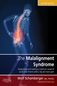 The Malalignment Syndrome_cover