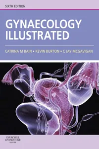 Gynaecology Illustrated_cover