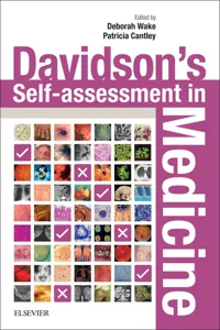 Davidson's Self-assessment in Medicine E-Book_cover