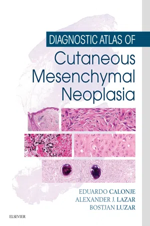 Diagnostic Atlas of Cutaneous Mesenchymal Neoplasia E-Book