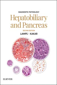 Diagnostic Pathology: Hepatobiliary and Pancreas E-Book_cover