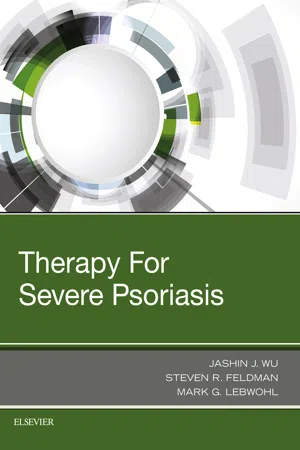 Therapy for Severe Psoriasis E-Book