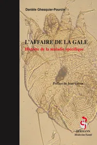 L'affaire de la gale_cover