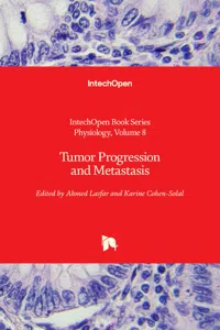 Tumor Progression and Metastasis_cover
