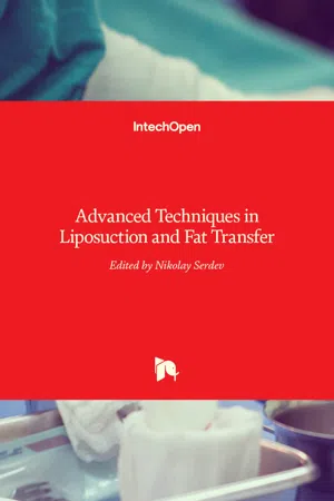 Advanced Techniques in Liposuction and Fat Transfer