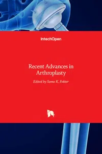 Recent Advances in Arthroplasty_cover