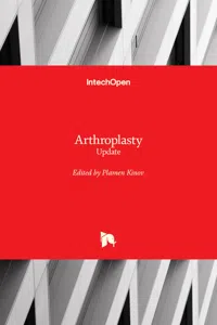 Arthroplasty_cover