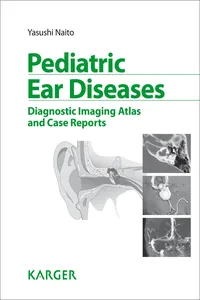 Pediatric Ear Diseases_cover