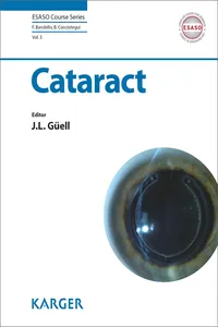Cataract_cover