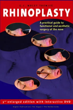 Rhinoplasty - Book (3rd enlarged edition)