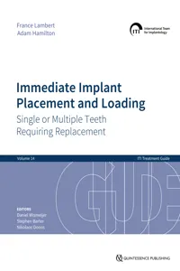 Immediate Implant Placement and Loading – Single or Multiple Teeth Requiring Replacement_cover
