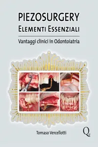 Piezosurgery_cover