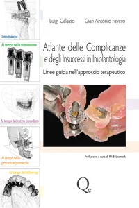 Atlante delle complicanze e degli insuccessi in implantologia_cover