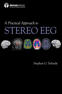A Practical Approach to Stereo EEG_cover