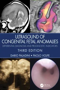 Ultrasound of Congenital Fetal Anomalies_cover