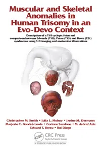 Muscular and Skeletal Anomalies in Human Trisomy in an Evo-Devo Context_cover