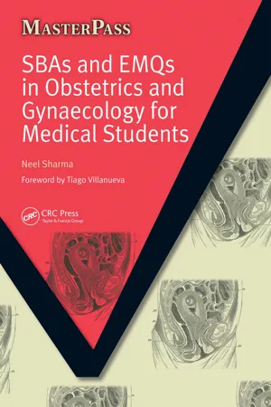 SBAs and EMQs in Obstetrics and Gynaecology for Medical Students