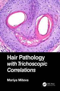 Hair Pathology with Trichoscopic Correlations_cover