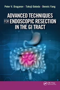 Advanced Techniques for Endoscopic Resection in the GI Tract_cover
