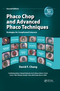 Phaco Chop and Advanced Phaco Techniques_cover
