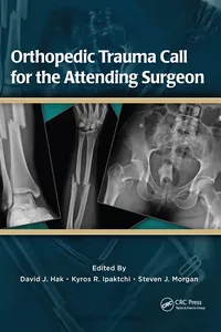 Orthopedic Trauma Call for the Attending Surgeon_cover