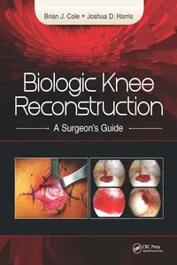 Biologic Knee Reconstruction_cover