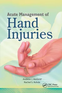Acute Management of Hand Injuries_cover