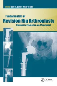 Fundamentals of Revision Hip Arthroplasty_cover