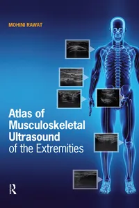 Atlas of Musculoskeletal Ultrasound of the Extremities_cover