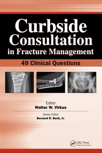 Curbside Consultation in Fracture Management_cover