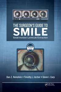 The Surgeon's Guide to SMILE_cover
