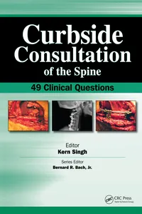 Curbside Consultation of the Spine_cover