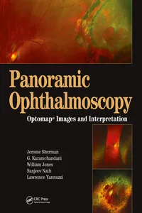 Panoramic Ophthalmoscopy_cover