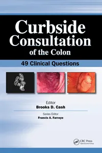 Curbside Consultation of the Colon_cover