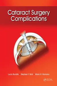 Cataract Surgery Complications_cover