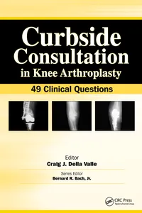 Curbside Consultation in Knee Arthroplasty_cover