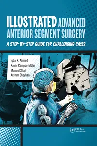 Illustrated Advanced Anterior Segment Surgery_cover