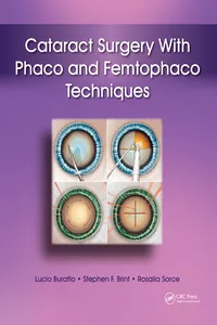 Cataract Surgery With Phaco and Femtophaco Techniques_cover
