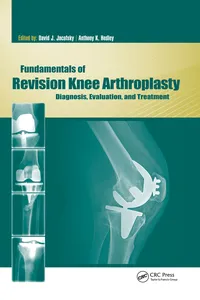 Fundamentals of Revision Knee Arthroplasty_cover
