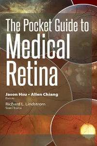 The Pocket Guide to Medical Retina_cover