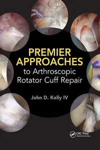 Premier Approaches to Arthroscopic Rotator Cuff Repair_cover