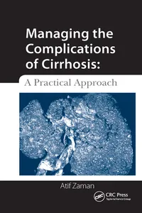 Managing the Complications of Cirrhosis_cover