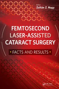 Femtosecond Laser-Assisted Cataract Surgery_cover